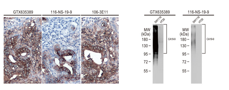 CA19-9 antibody [GT933]